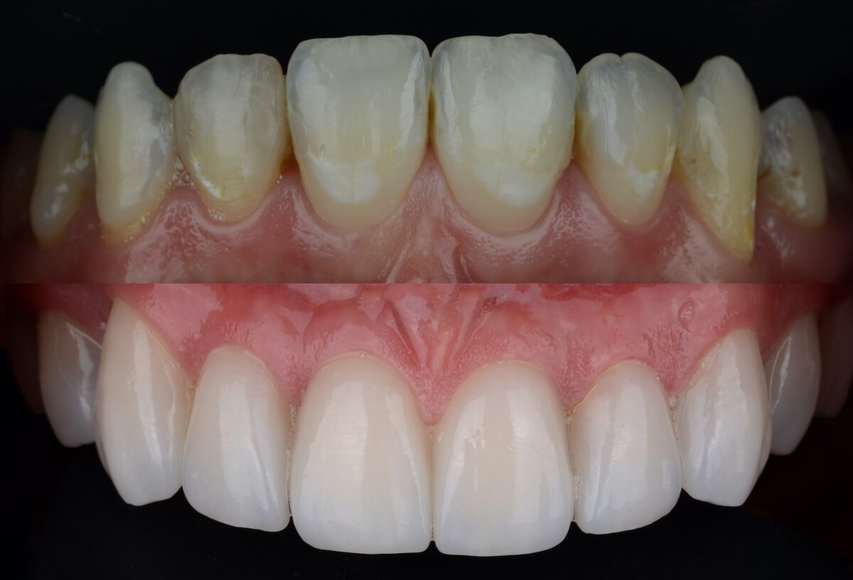 Featured image for “Cosmetic Dental Treatments”
